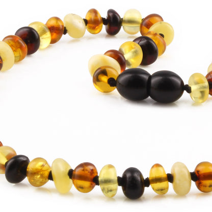 KALUNG AMBER UNTUK BAYI TUMBUH GIGI XR63M2